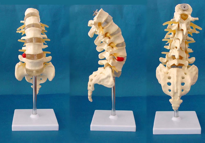 人体1:1可拆5节腰椎t尾骨模型脊椎椎间盘突出人体教学骶骨